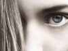 Las blefaroplastias aumentan en verano, pero el postoperatorio es más complejo Las blefaroplastias